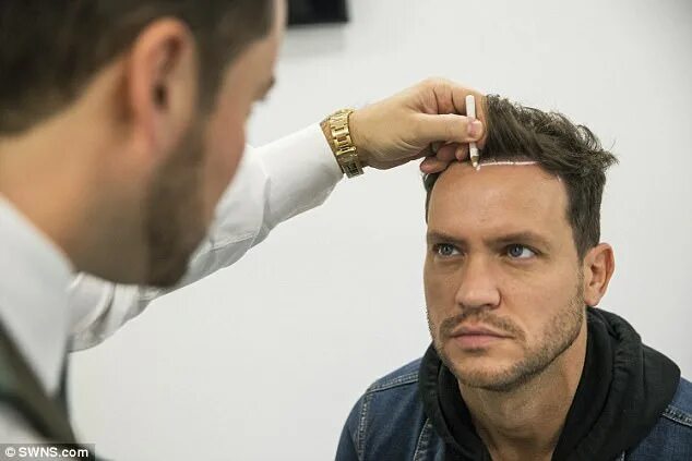 Прически скрывающие лоб мужские TOWIE's Jamie Reed proudly shows off hair transplant Daily Mail Online