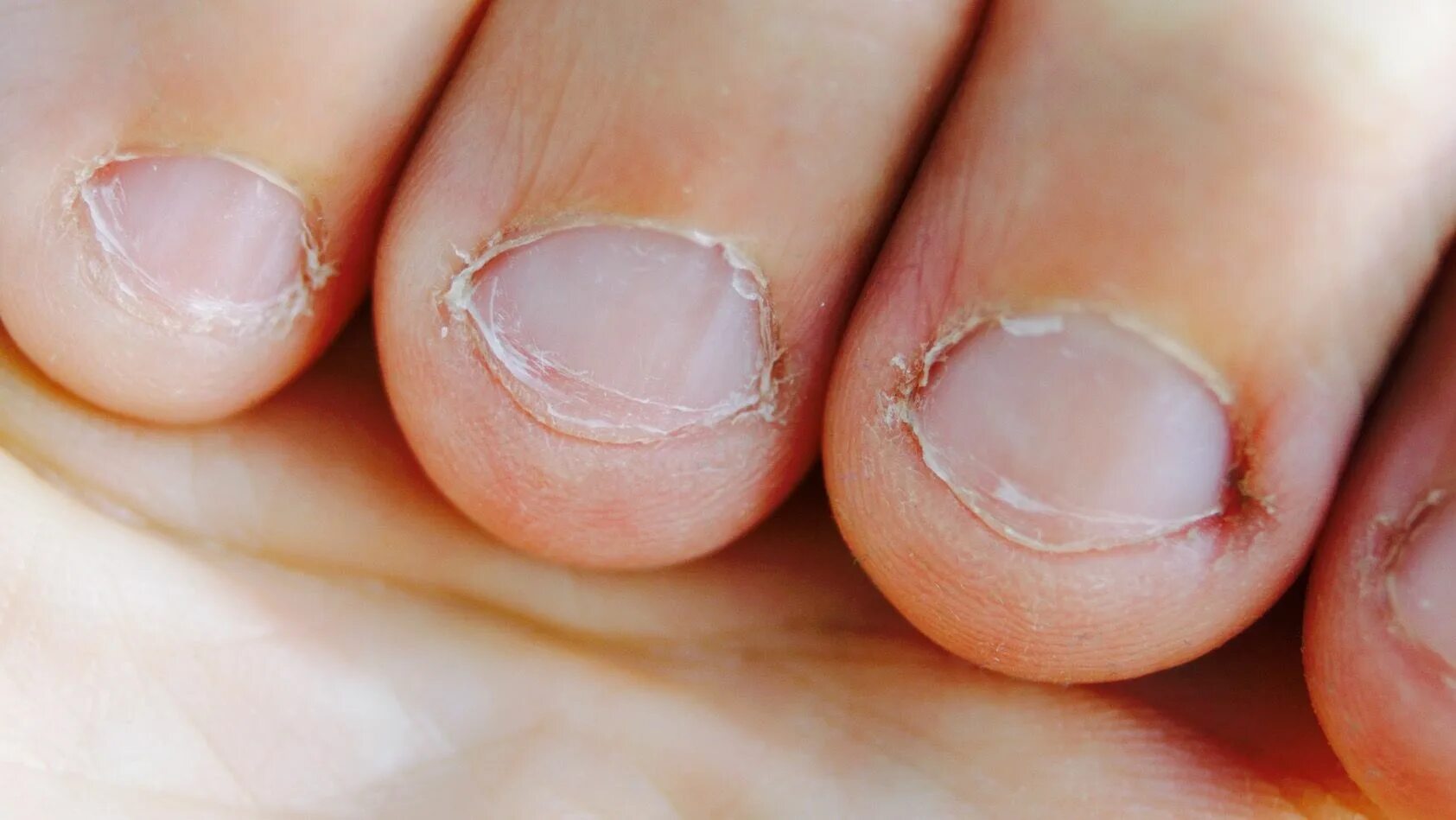 Причина ногтях фото Researchers Explain What Biting Your Nails Says About Your Personality