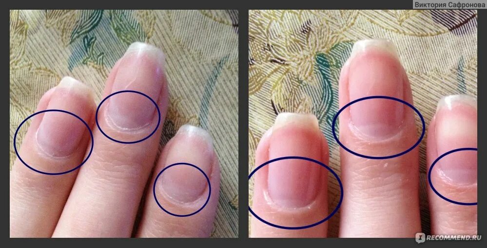 Причина ногтях фото Средство для удаления кутикулы DIVAGE BB nail cure cuticle away - "Сделать краси