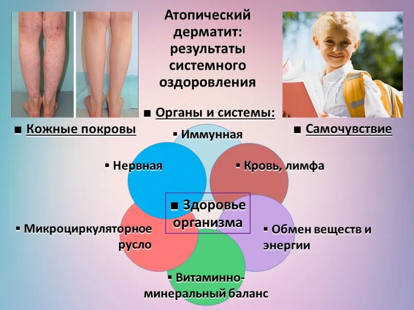 Причины атопического дерматита у взрослых фото Интересное про Атопический дерматит мамам https://www.atopia.live/atopicheskij-d