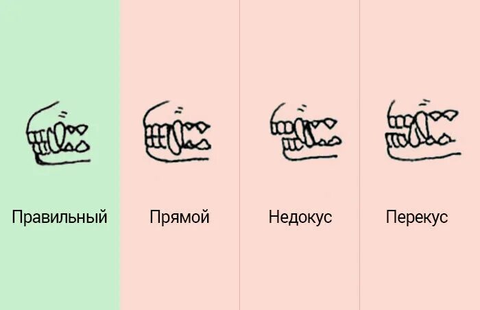 Прикус немецкой овчарки правильный фото Строение немецкой овчарки согласно стандарту Гавкуша Дзен