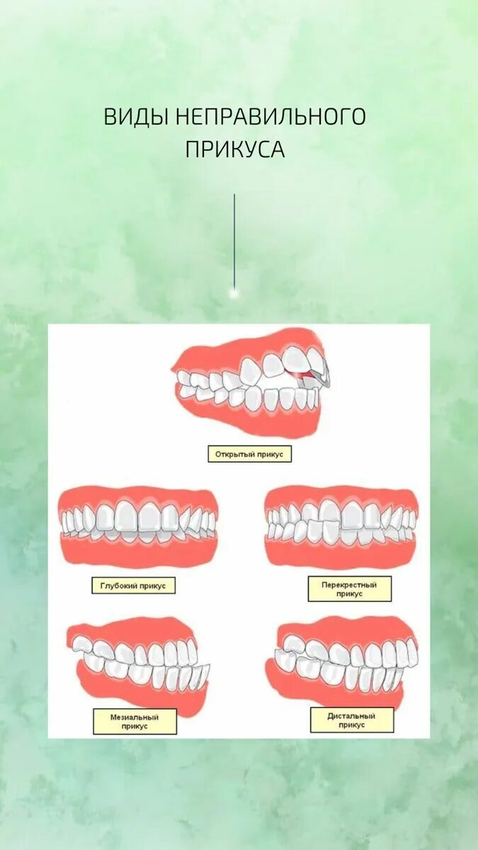 Прикус зубов правильный и неправильный фото Будьте сами стоматологом! Вылечите кариес, десна и отбелите зубы с этой НАТУРАЛЬ