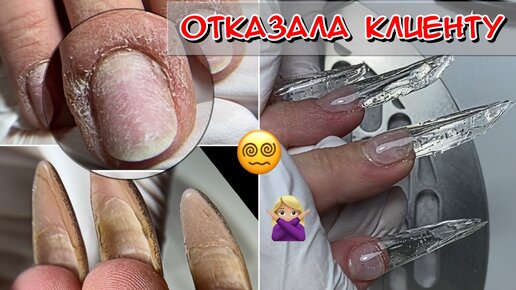 Пример как отказать клиенту в маникюре Отказала клиенту / Как отказать клиенту / Наращивание ногтей / Наращивание на ни