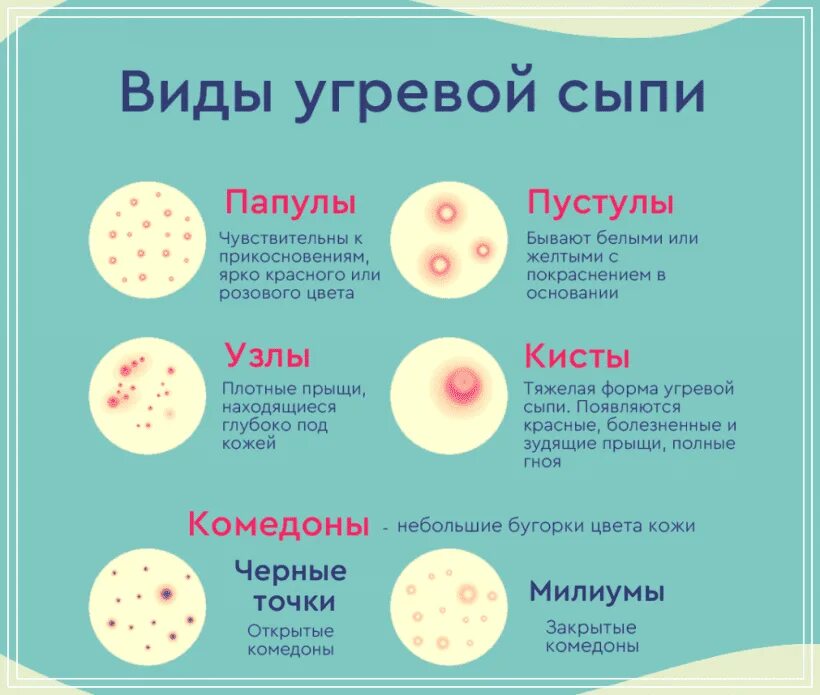 Примеры сыпи фото Угревая сыпь на лице: виды, причины и лечение в домашних условиях