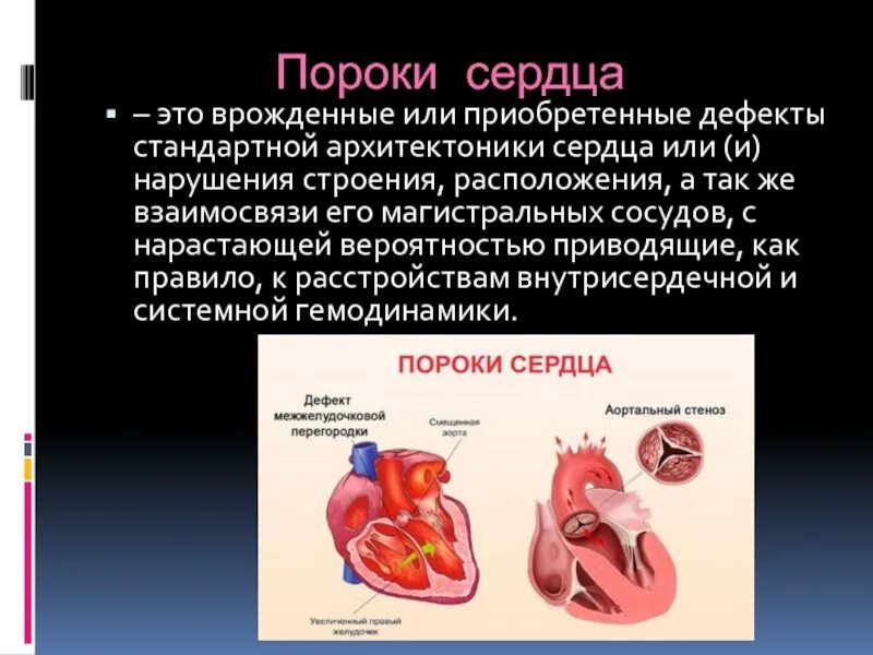 Приобретенные пороки сердца фото Приобретенные пороки сердца у детей - найдено 88 картинок