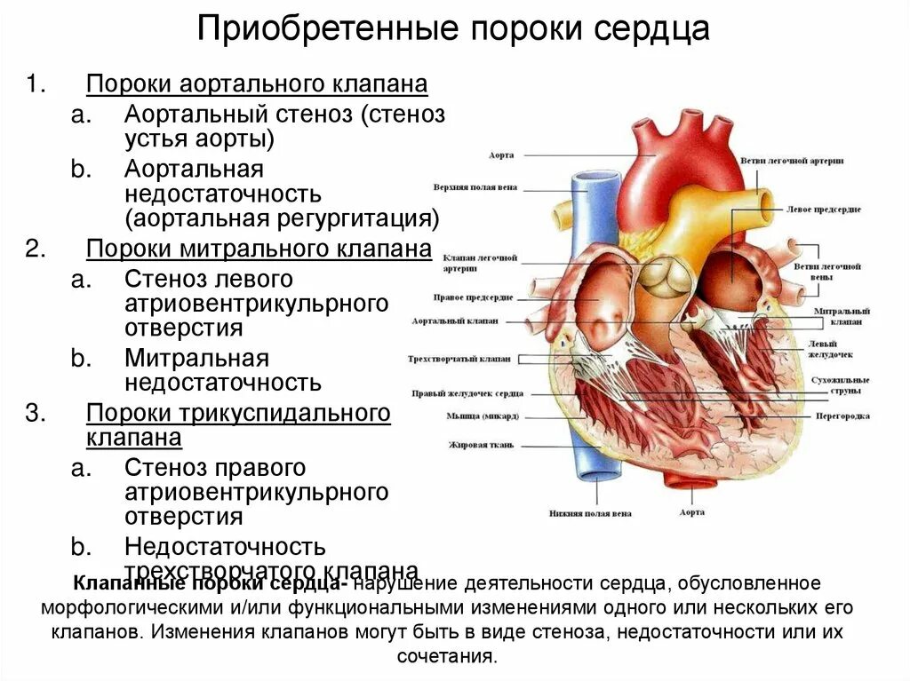 Приобретенные пороки сердца фото Приобретенные пороки развития сердца