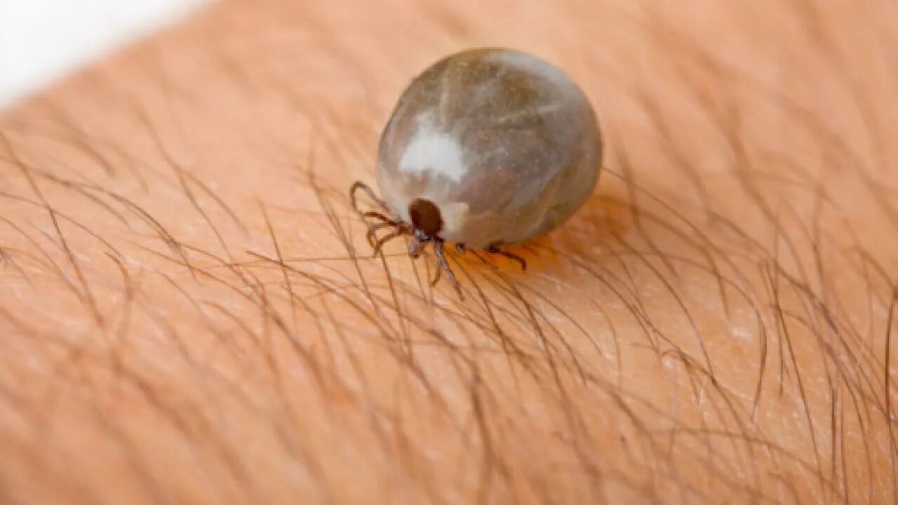 Присосавшийся клещ на коже человека фото Lyme Disease Q & A Columbia University Irving Medical Center