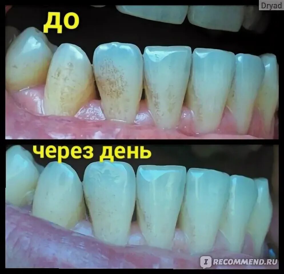 Пристли налет на зубах фото Зубной порошок Viset-Niyom Traditional Tooth Powder Тайский - "Вместо профессион