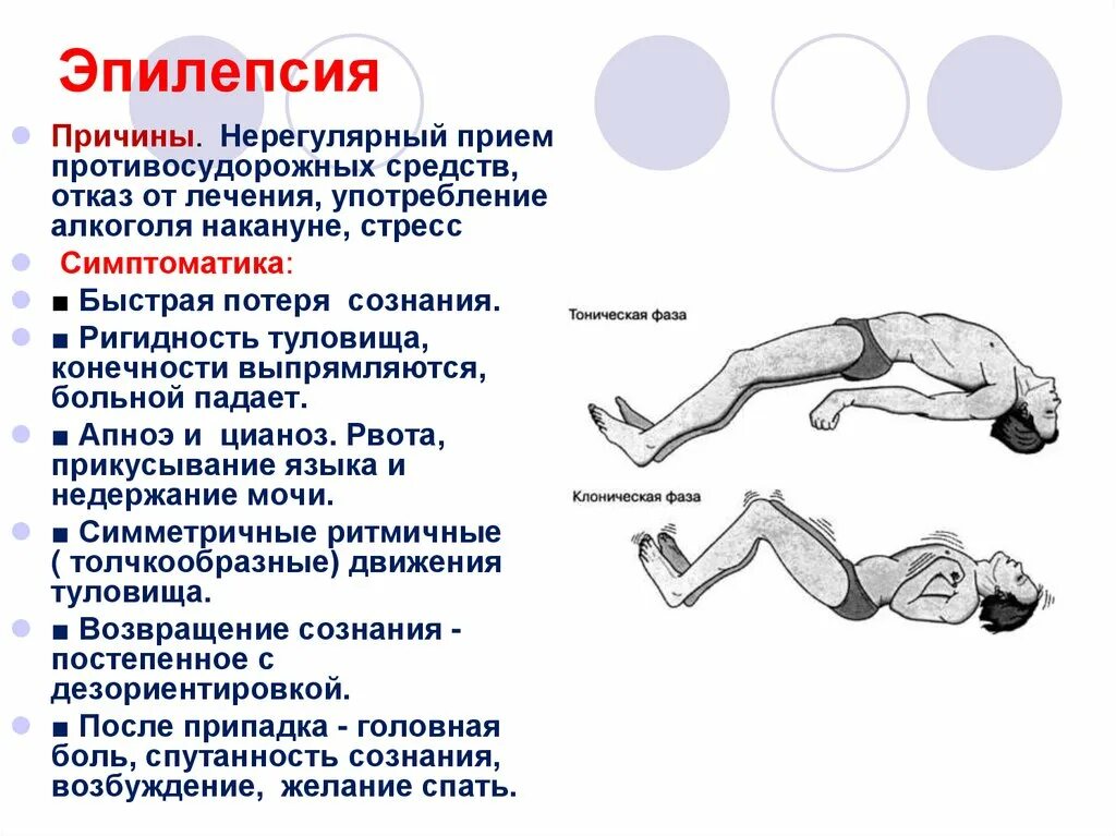 Приступ эпилепсии у кошки как выглядит Начальная эпилепсия