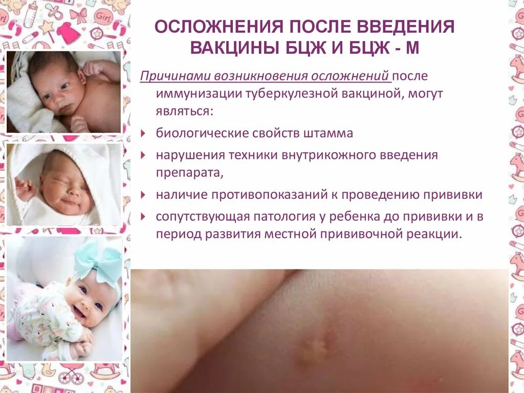 Прививка бцж фото по месяцам Когда и зачем делают вакцинацию БЦЖ младенцам в роддоме: заживление, осложнения