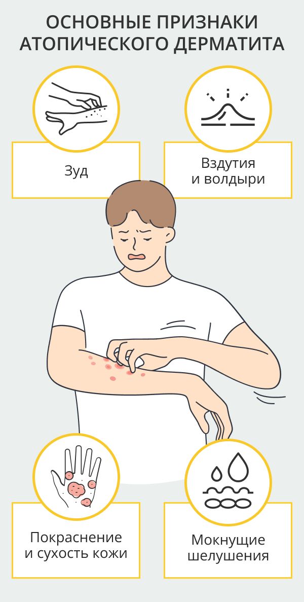 Признаки атопического дерматита у взрослых фото Признаки Атопического Дерматита Clinic, You are invited, Chat