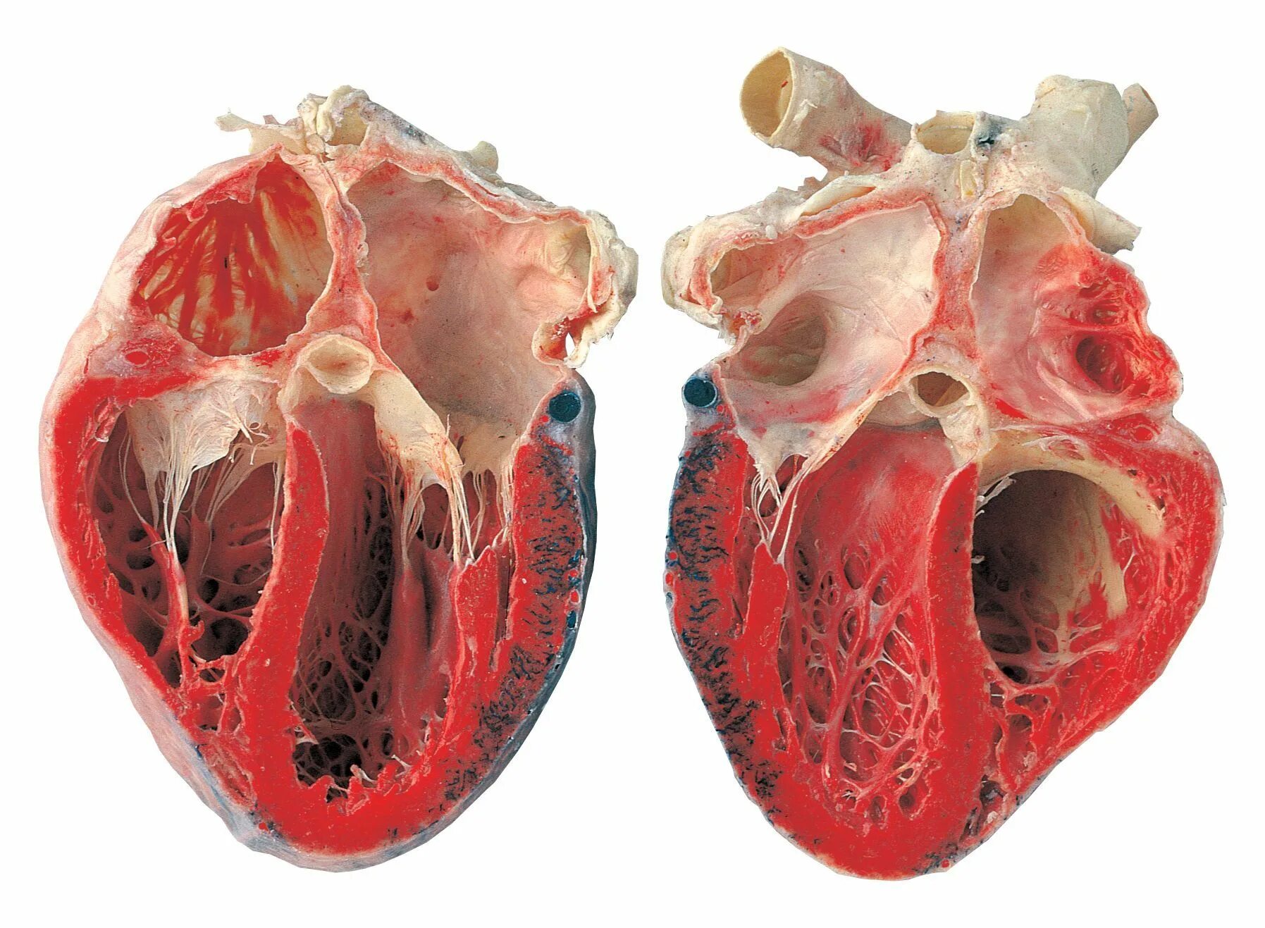 Признаки фото сердца Human heart, Anatomy, Science and nature