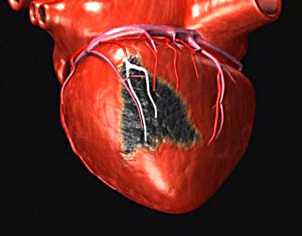 Признаки фото сердца These symptoms of an impending heart attack HRONIKA.info - micetimes.asia