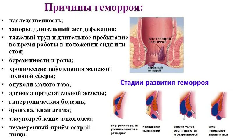 Признаки геморроя как выглядит Геморроидальное кровотечение карта смп