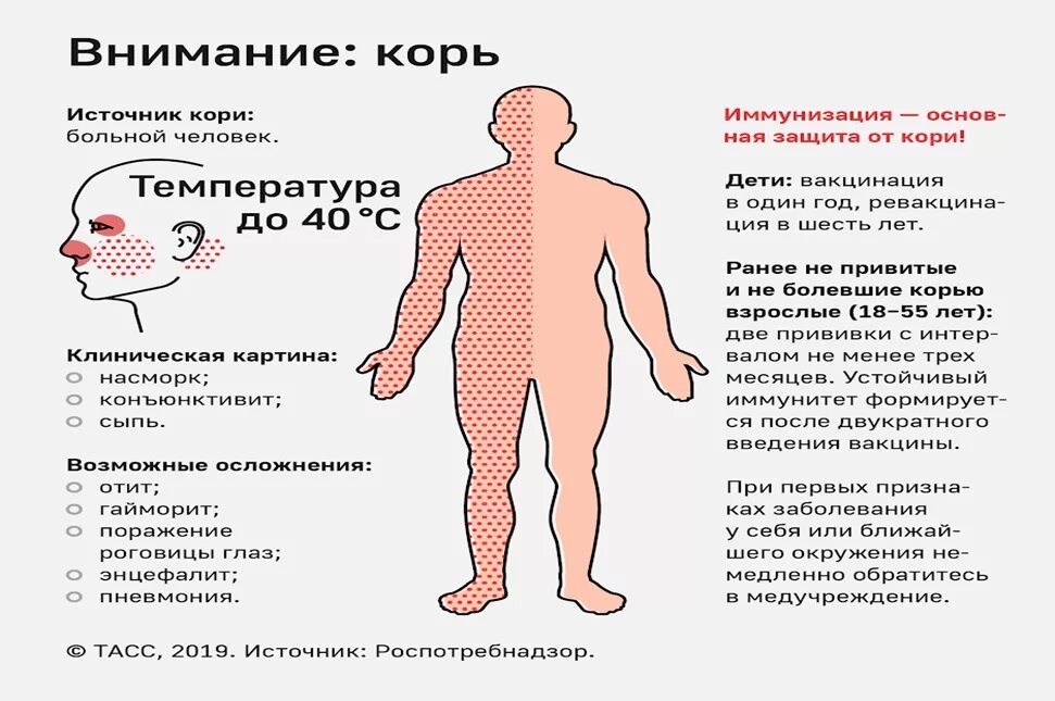 Признаки кори у взрослых симптомы фото лечение Администрация Новгородского муниципального района РЕКОМЕНДАЦИИ ГРАЖДАНАМ: корь