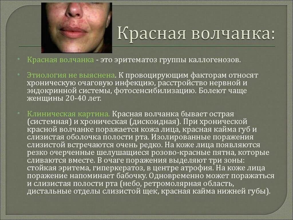 Признаки красной волчанки фото Вощанка - CoffeePapa.ru