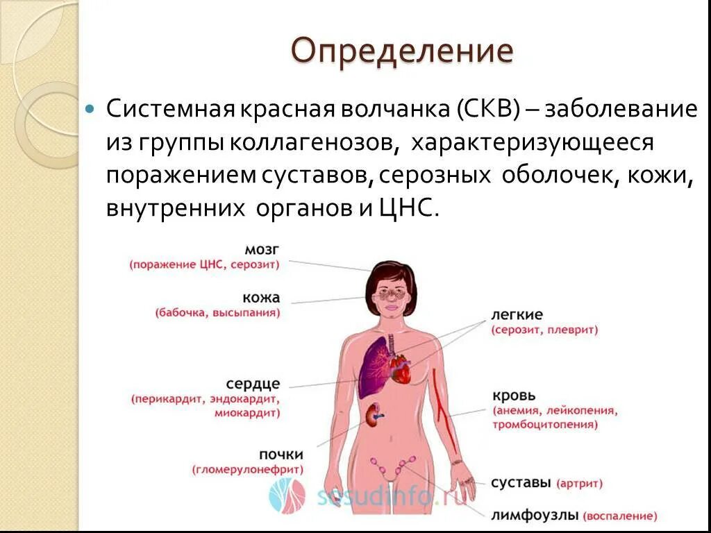 Признаки красной волчанки фото Картинки ЧТО ТАКОЕ КРАСНАЯ ВОЛЧАНКА СИМПТОМЫ