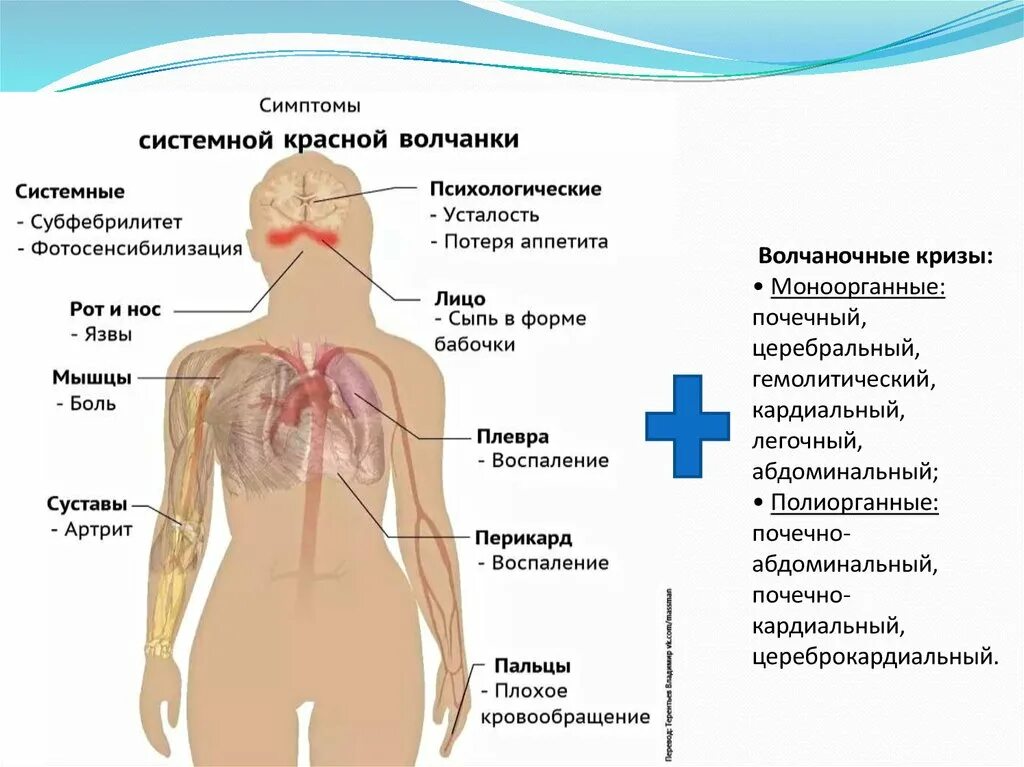 Признаки красной волчанки фото Системная красная волчанка клинические рекомендации презентация