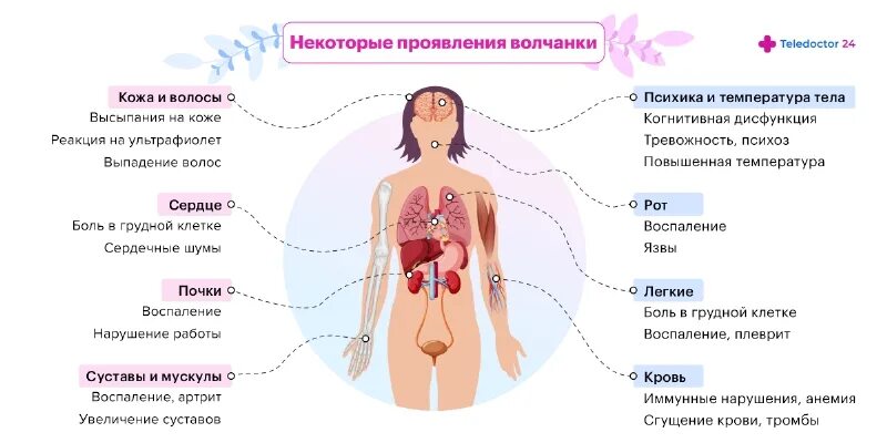 Признаки красной волчанки у женщин фото Что такое системная красная волчанка: симптомы, причины, диагностика, лечение