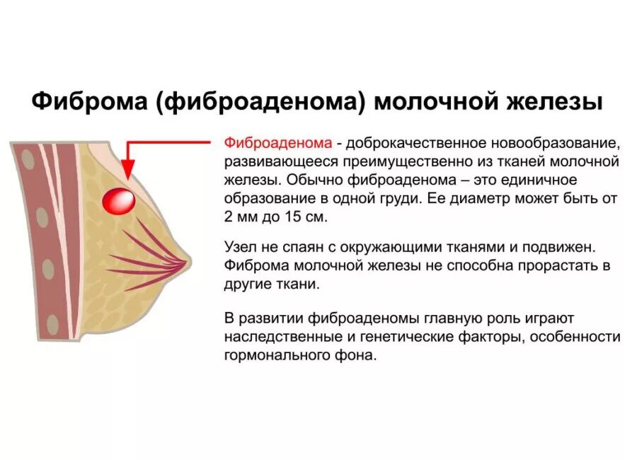 МАСТОПАТИЯ ▷ Диагностика, симптомы и лечение Medical Plaza