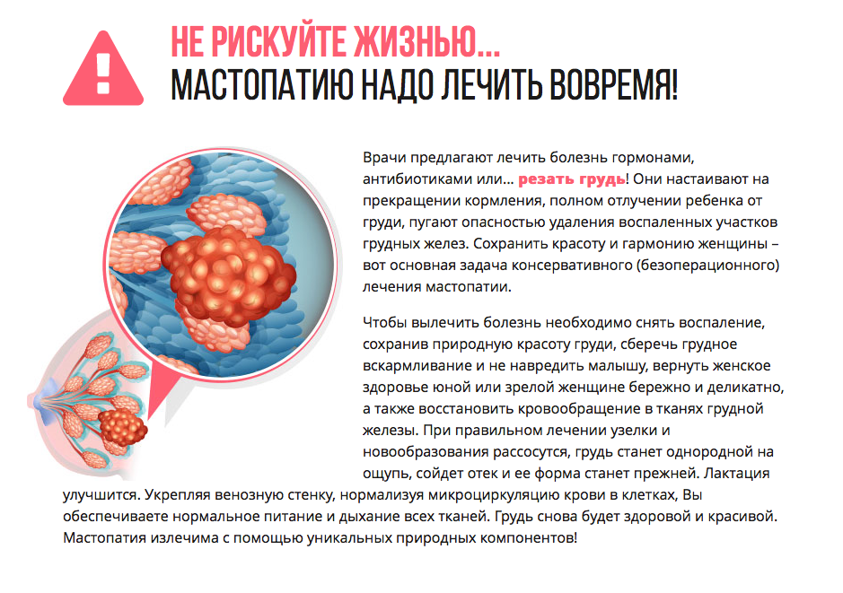 Признаки мастопатии у женщин симптомы фото Лечат ли мастопатию? Doccentr Дзен