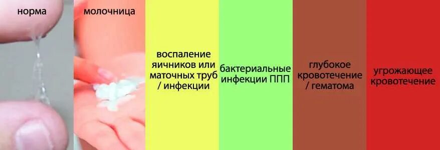 Признаки молочницы у мужчин симптомы фото Картинки О ЧЕМ ГОВОРИТ ЦВЕТ ВЫДЕЛЕНИЙ