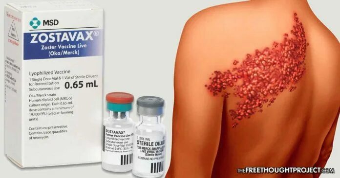 Признаки опоясывающего лишая фото Vaccine failure: Merck being sued for shingles vaccine that causes the afflictio