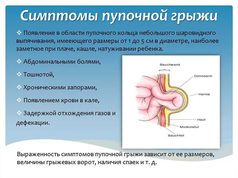 Признаки пупочной грыжи у женщин симптомы фото Пупочная грыжа у детей: симптомы