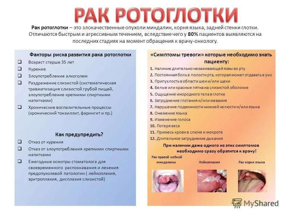 Признаки рака горла и гортани фото Информационные материалы по раннней диагностике новообразований полости рта и гл