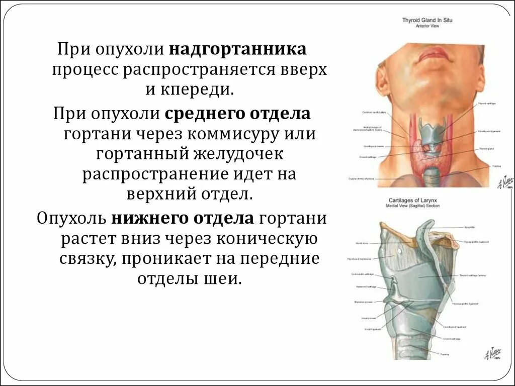 Признаки рака горла у женщин симптомы фото Болит гортань причины