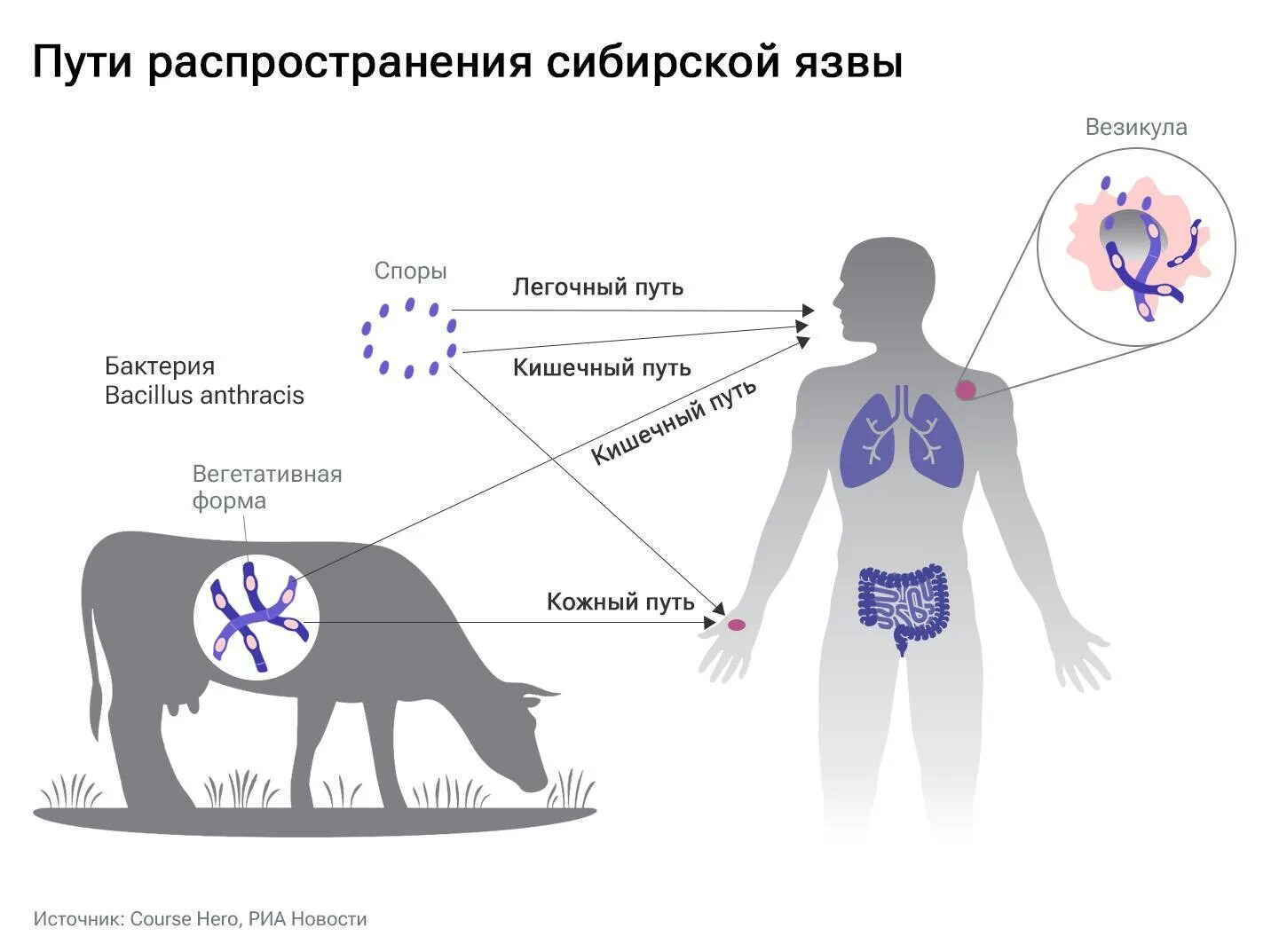 Признаки сибирской язвы фото В России сибирская язва. Кто в зоне риска и что им грозит - РИА Новости, 24.03.2