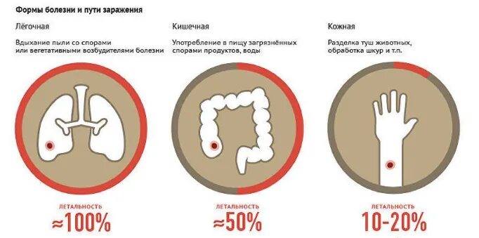 Признаки сибирской язвы фото Сибирская язва: что это, как передается, как протекает, методы лечения