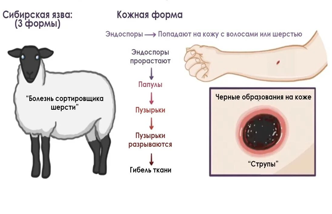 Признаки сибирской язвы фото ОСТОРОЖНО, СИБИРСКАЯ ЯЗВА! МЕРЫ ПРЕДУПРЕЖДЕНИЯ И ЗАЩИТЫ