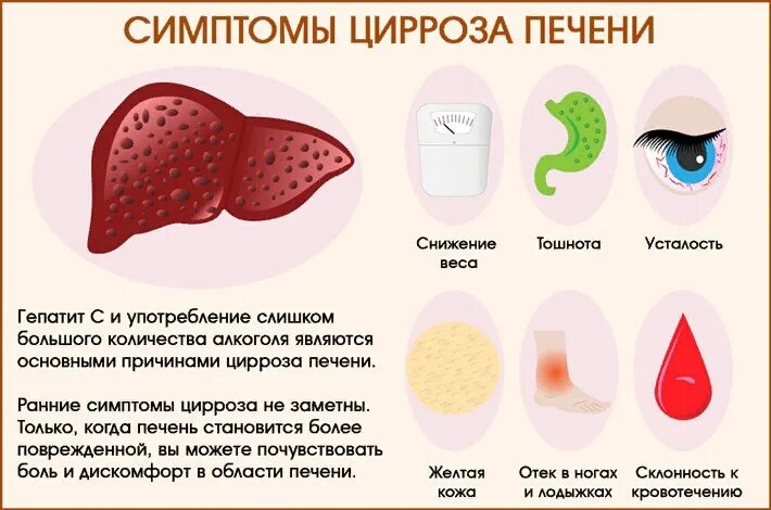 Признаки цирроза печени у женщин фото Лечении болезней печени у женщин - найдено 77 картинок