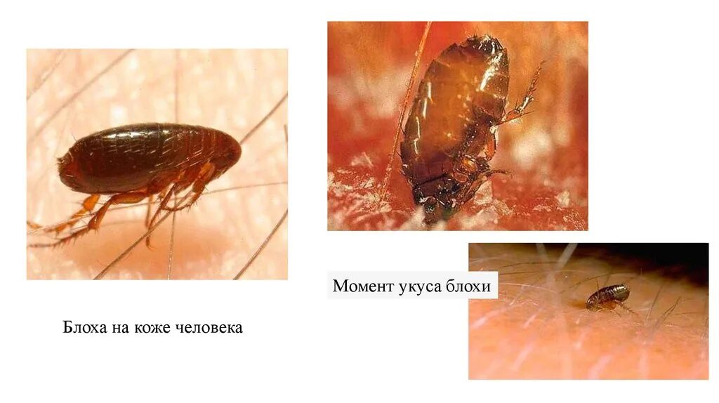 Признаки укусов блох у людей фото Обработка от блох в Энгельсе Цены на услугу - Городская служба дезинсекции