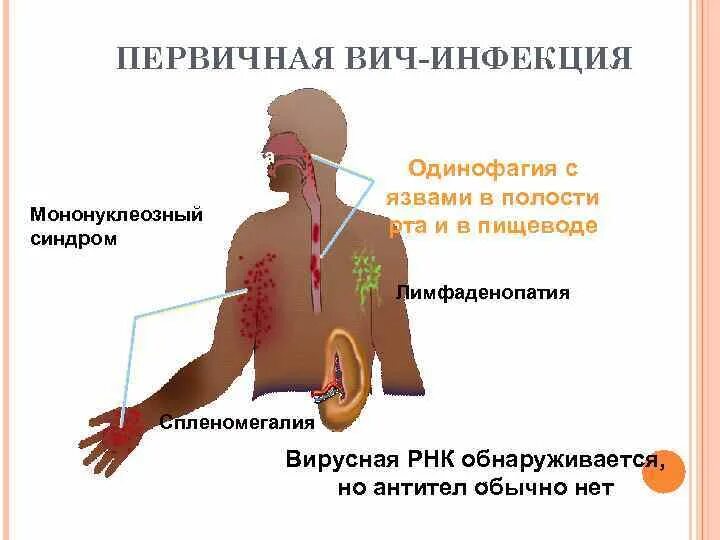 Признаки вич сыпь фото Фото Инфекционных Высыпаний На Коже - Mixyfotos.ru