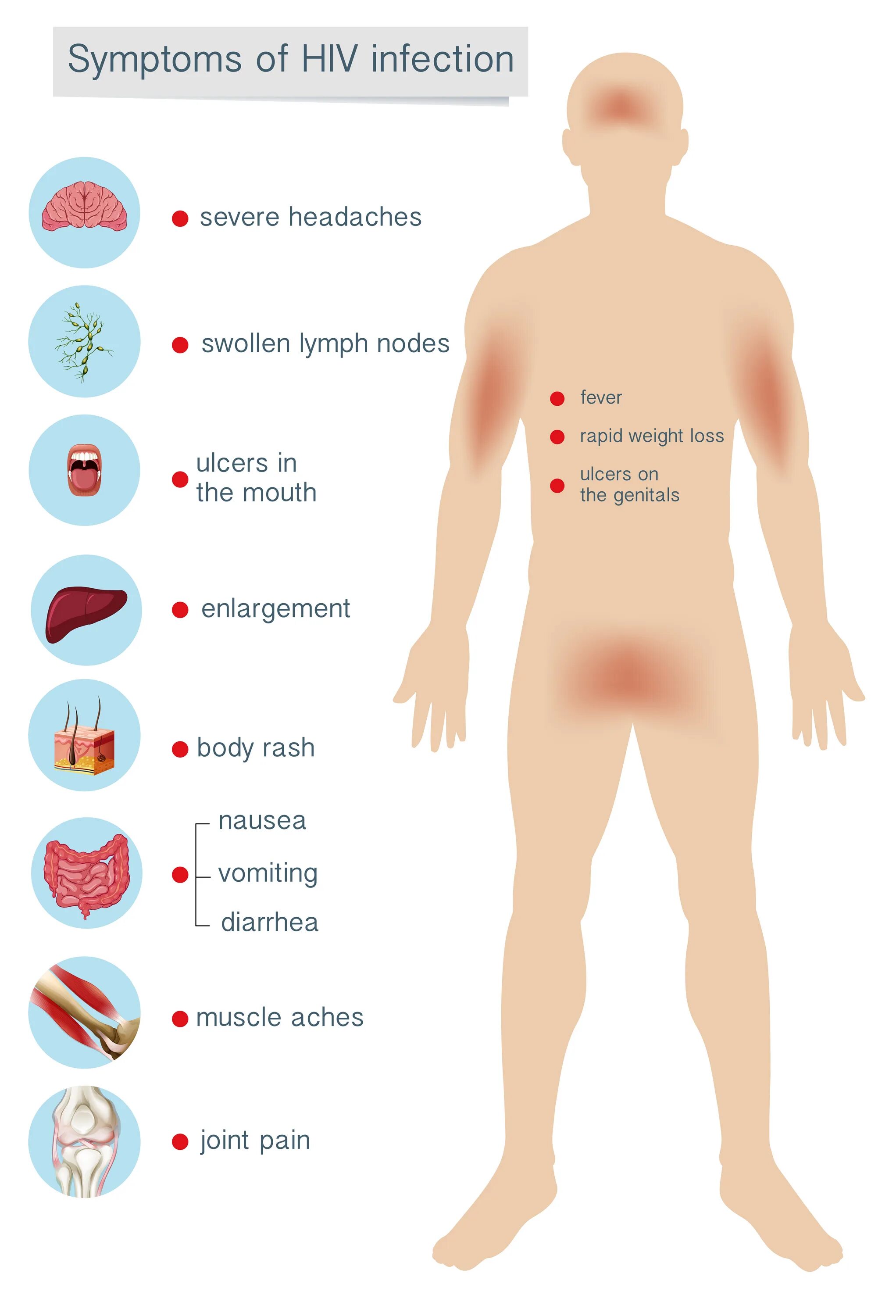 Признаки вич сыпь фото Human Anatomy Symptoms of HIV Infection 301888 Vector Art at Vecteezy