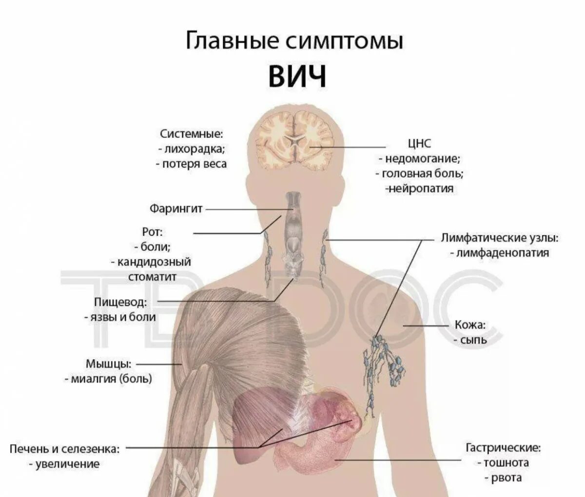 Признаки вич у мужчин фото симптомы Какие признаки и симптомы могут говорить о ВИЧ-инфекции? - Профилактика - ГБУЗ Г