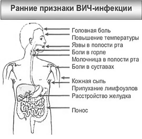 Признаки вич у мужчин фото симптомы Первая стадия вич