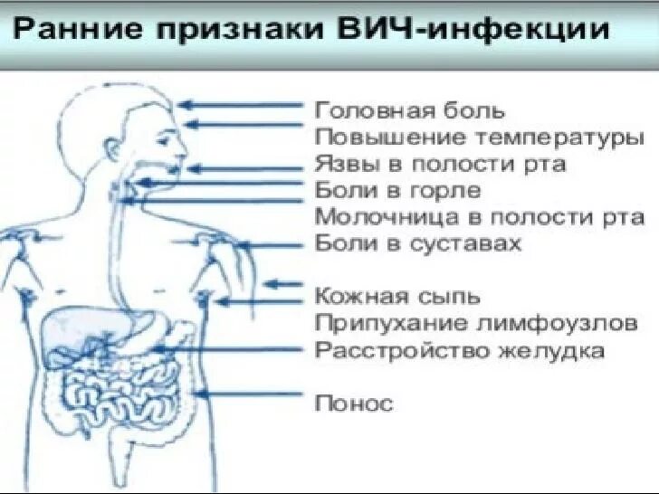 Признаки вич у мужчин фото симптомы Первая стадия вич симптомы