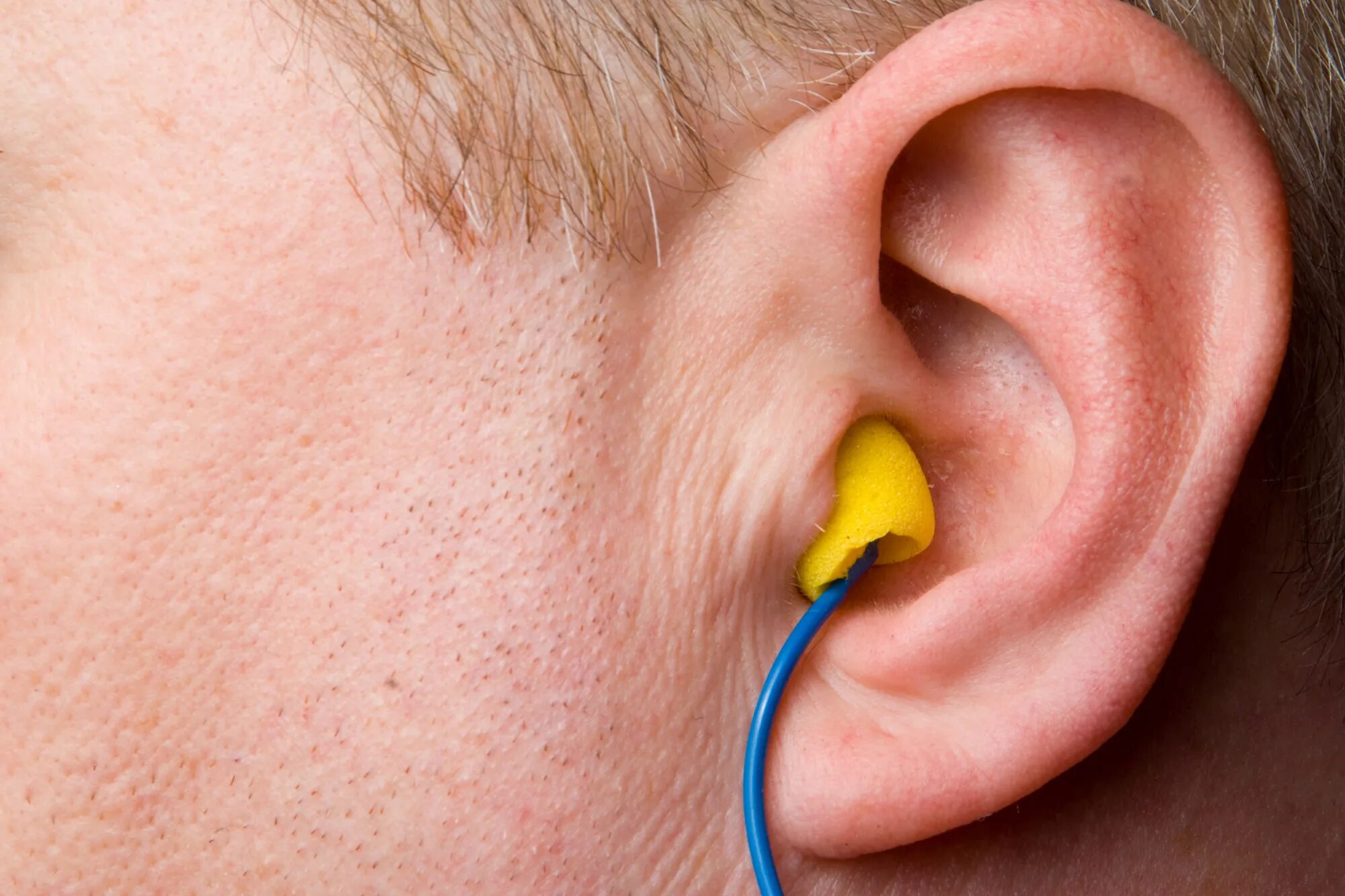 Пробка в ухе фото Scammer sold ear-buds to state workers then billed insurance for hearing aids: o