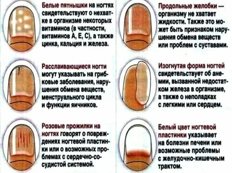 Проблемы ногтей фото Почему ногти полосками на руках: найдено 88 изображений