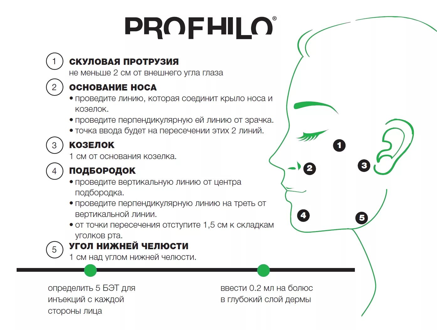 Профайло точки введения фото с описанием Profhilo: Революция в Антивозрастной Медицине для Молодой и Здоровой Кожи filler