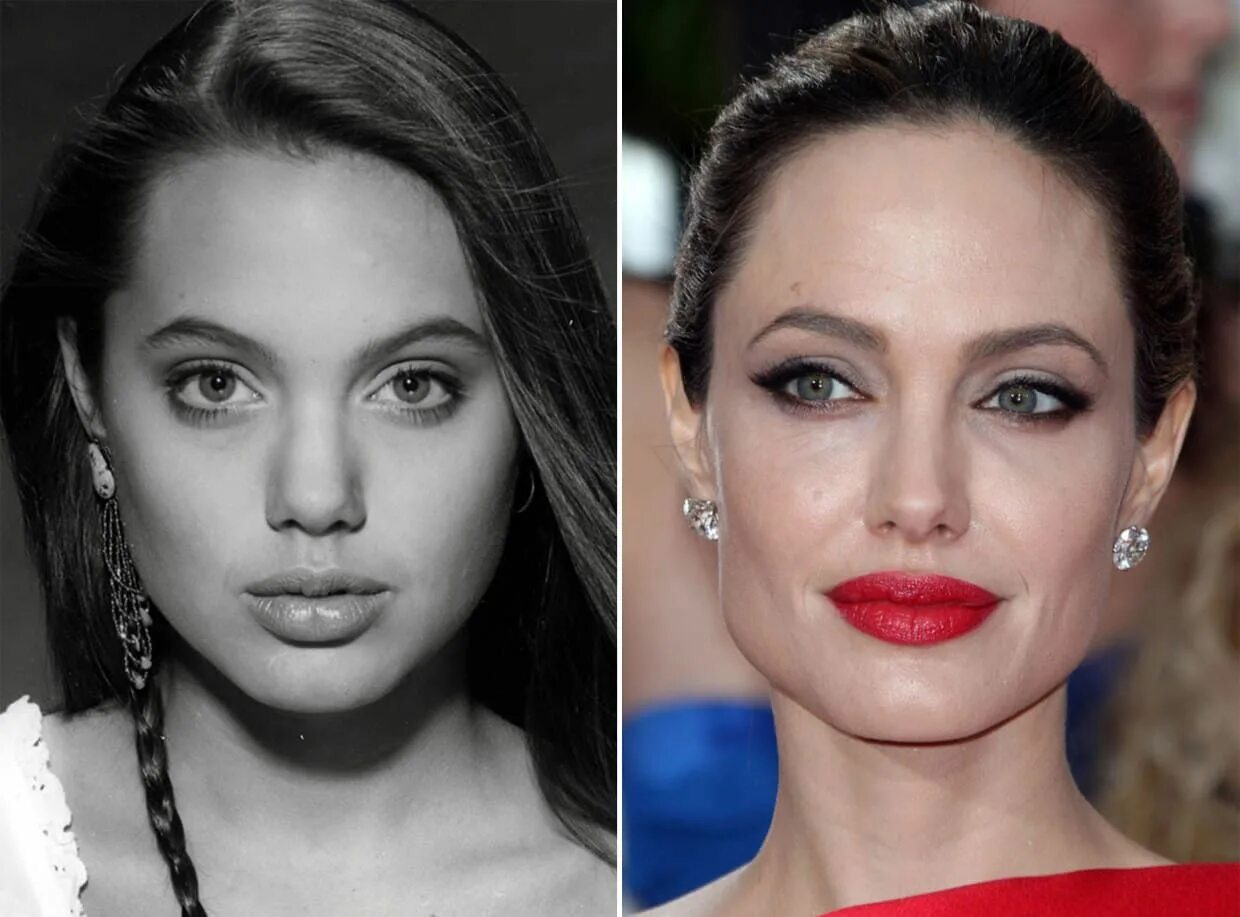 Профиль джоли фото до и после Angelina Jolie, Before and After Angelina jolie nose, Angelina jolie plastic sur