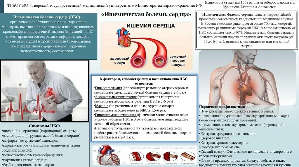 Профилактика ишемической болезни сердца фото Ишемическая болезнь сердца - презентация онлайн