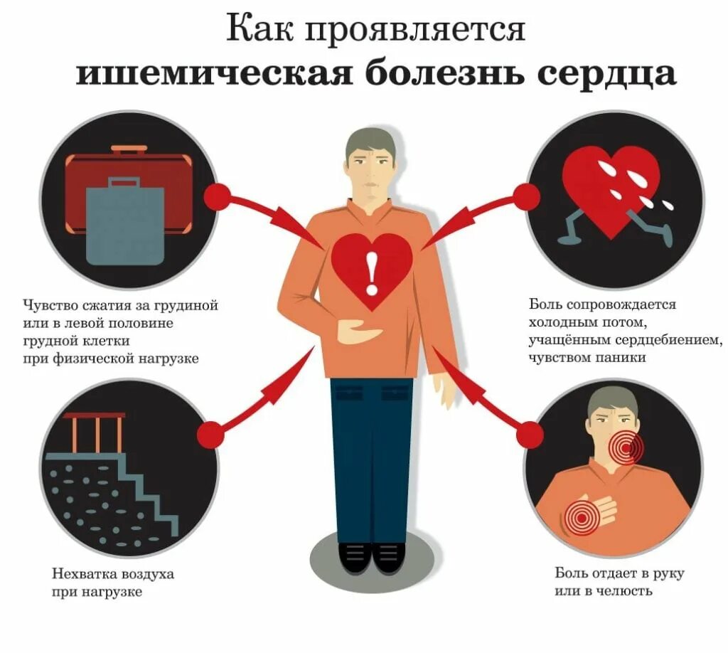 Профилактика ишемической болезни сердца фото Ишемическая болезнь сердца: симптомы и лечение - Klinik.by