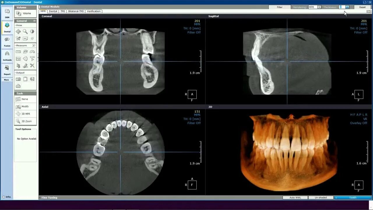 Программа фото математик Oprogramowanie OnDemand3D moduł dental - YouTube