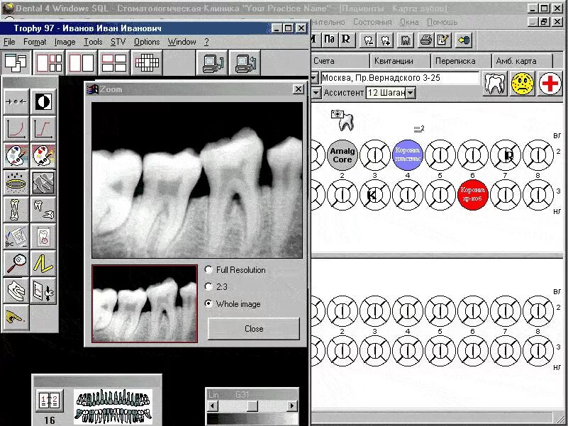 Программа клиника для стоматологии фото Программа для стоматологии Dental4Windows (D4W)