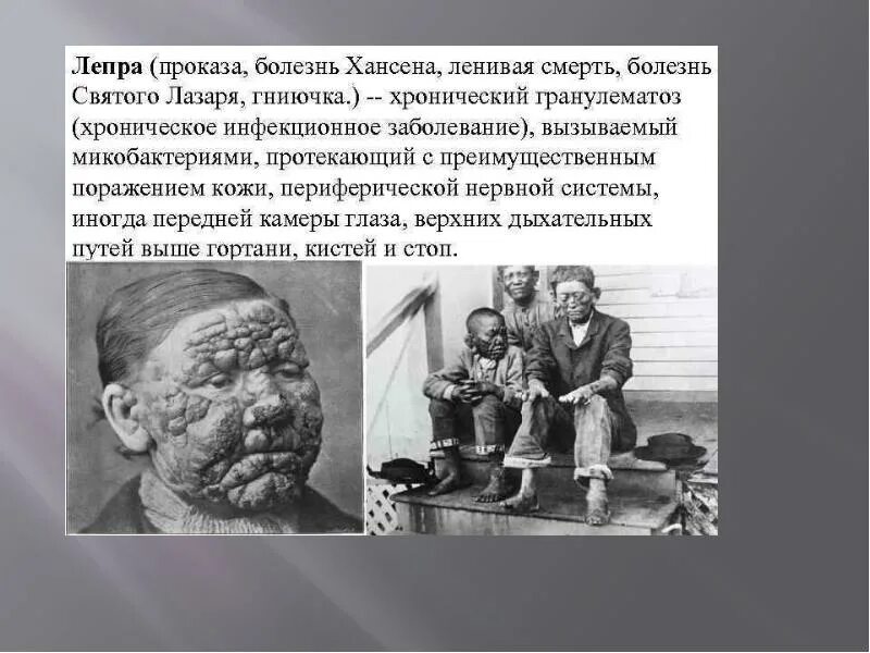 Проказа что за болезнь простыми словами фото Тема : "Забытые болезни": оспа, чума и лепра в средневековье