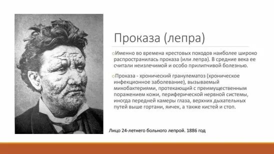 Проказа что за болезнь симптомы фото Ежегодно 25 апреля во всем мире отмечают день борьбы с малярией.... Интересный к